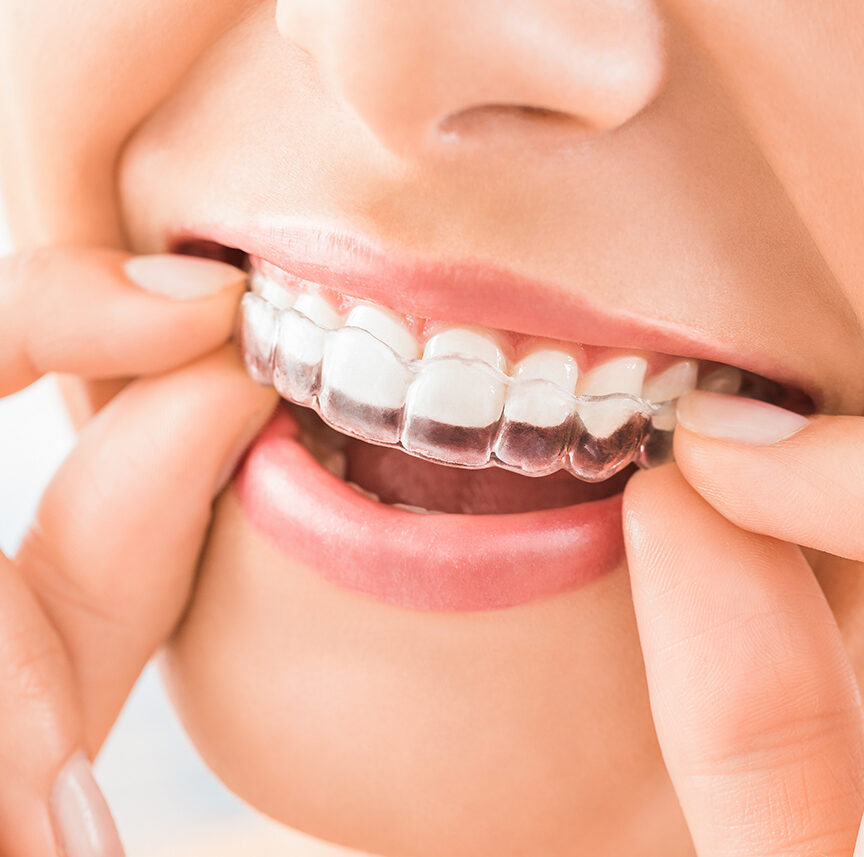 ブランデンタルケアクリニック学芸大学のデュアルホワイトニングのイメージビジュアル